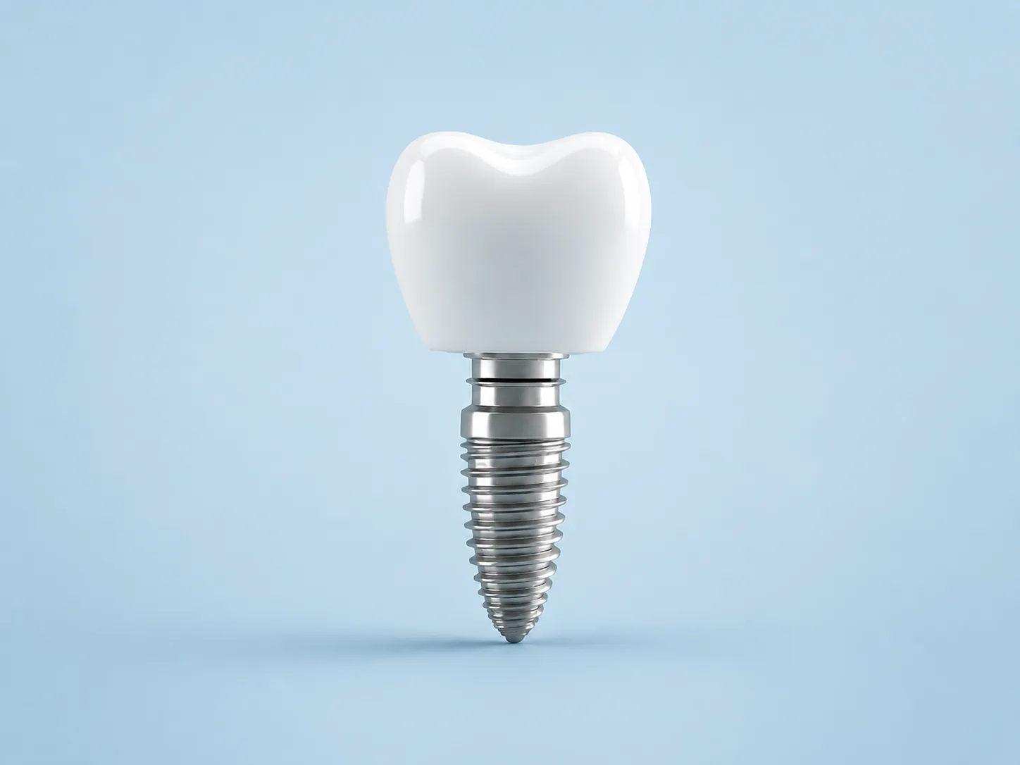 Servicio de implantes dentales
